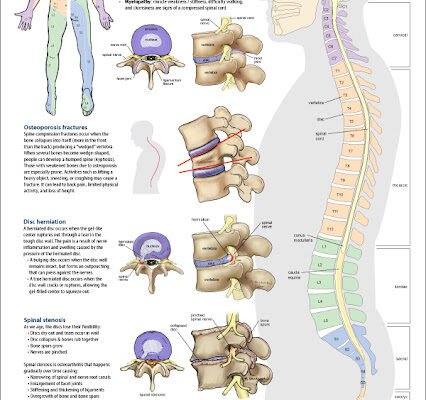 Spine Wounds and Conditions