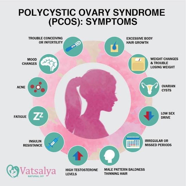 Understanding Polycystic Ovary Syndrome (PCOS) in Teenage Girls