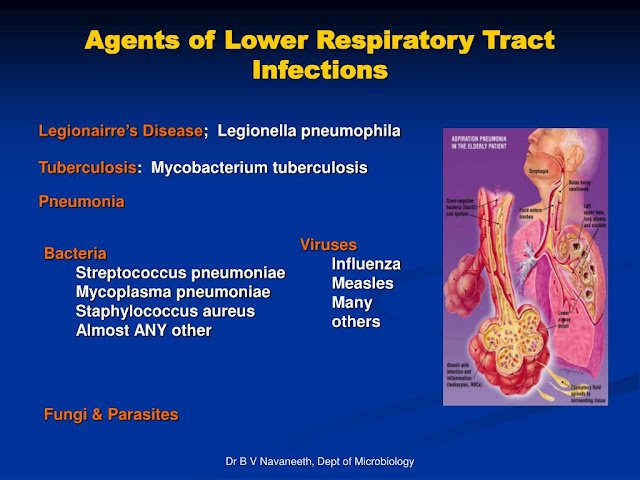 2024-2025 Respiratory Disease