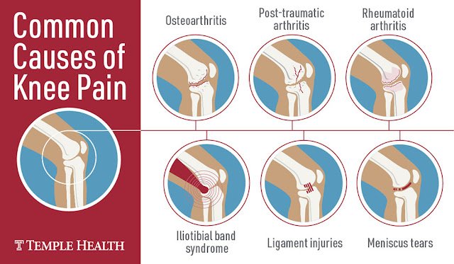 Spine Injuries