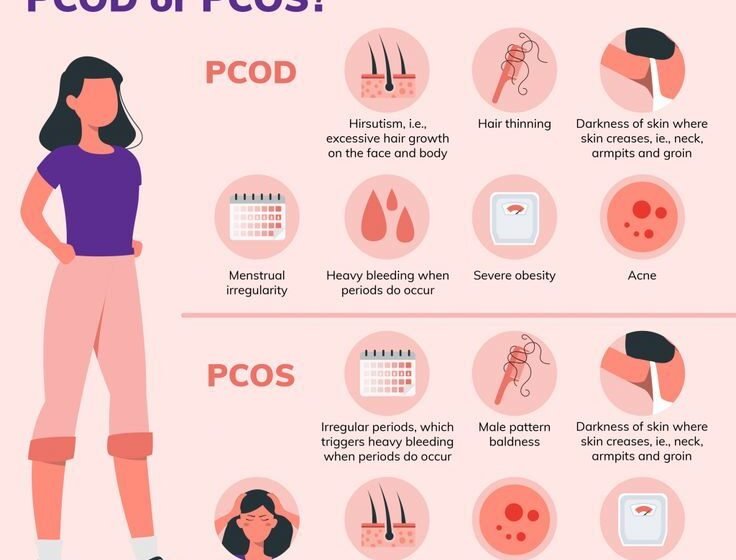 PCOS&PCOD