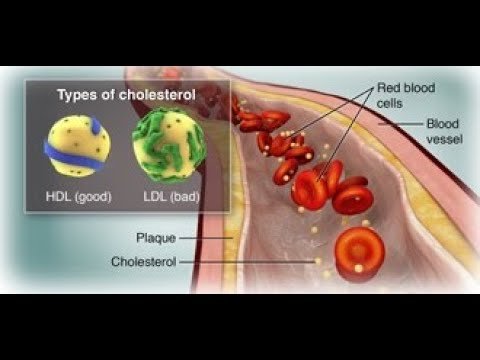 Cholesterol